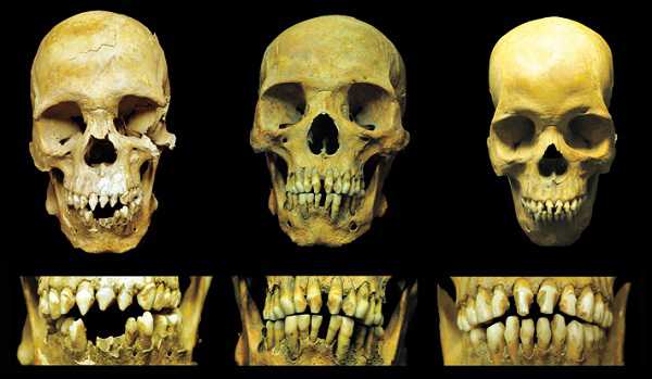 Mexico City Skulls Teeth Combo